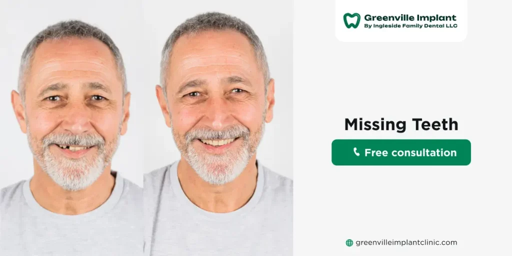 cheap options for missing teeth